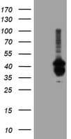 PDSS2 / DLP1 Antibody (clone OTI1C4, Carrier-free)