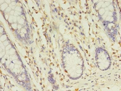 Polyclonal Rabbit anti-Human TLT2 / TREML2 Antibody (IHC)
