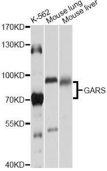 GARS / Glycyl tRNA Synthetase Antibody