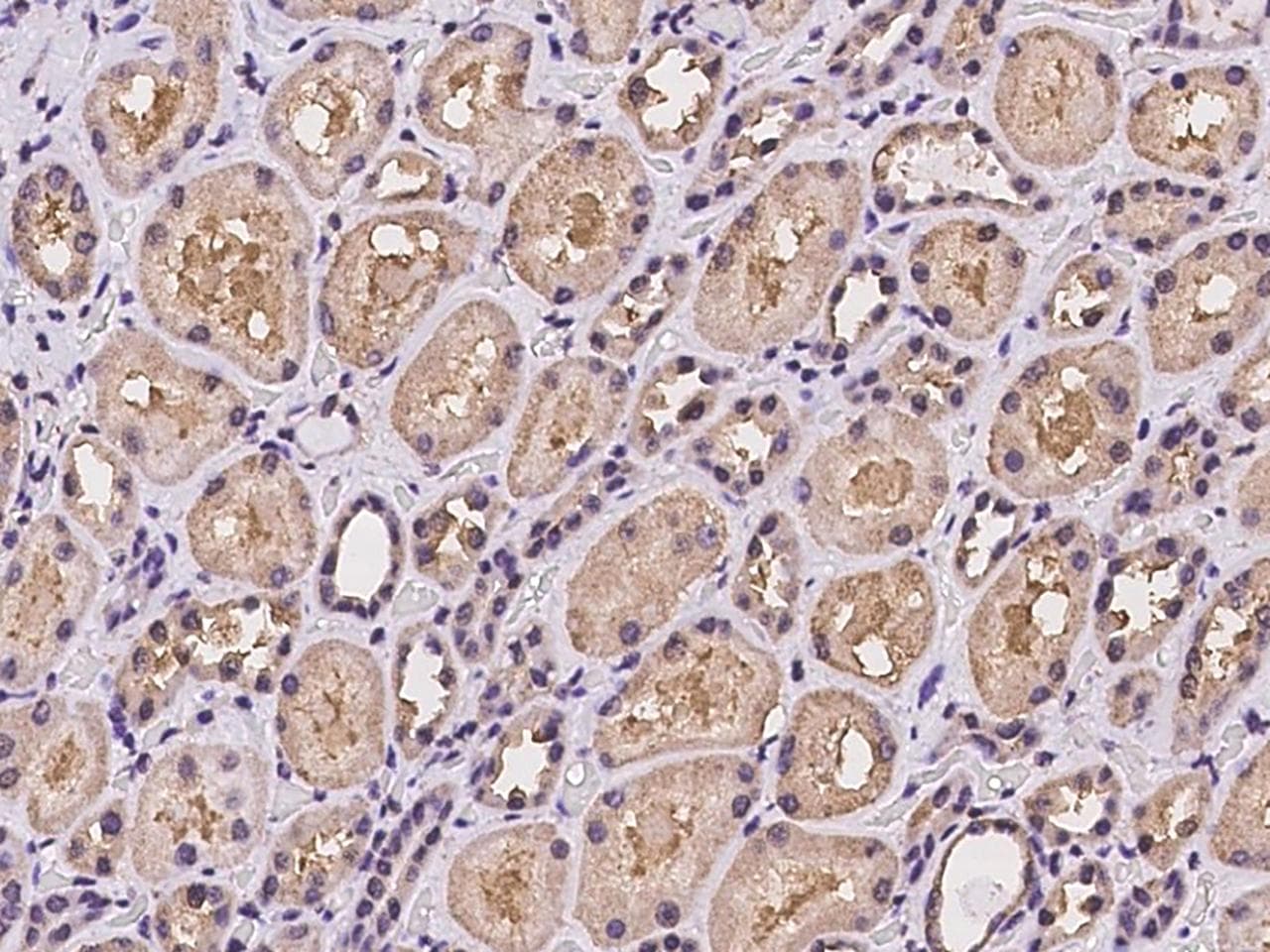 Polyclonal Rabbit anti-Human WDR1 Antibody (IHC)