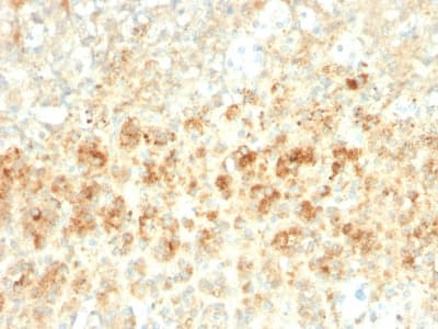 PLIN2 / ADFP / Adipophilin Antibody (aa 249-376, clone ADFP/2755R)