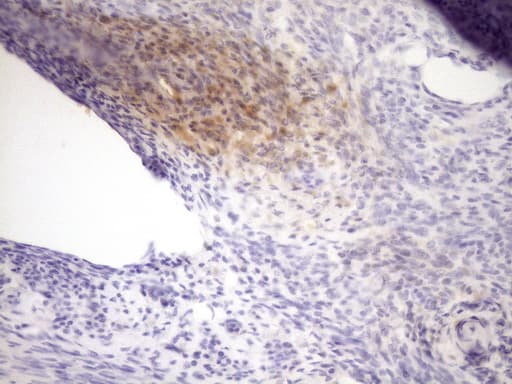 LOXL2 Antibody (aa152-450, clone OTI8B2)