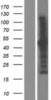 Human CEP44 / KIAA1712 Protein (Over-Expression Lysate Myc-DDK (Flag))