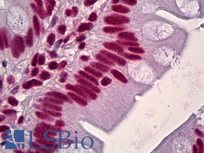 IHC-plus™ HNRNPD / AUF1 Antibody (aa49-98)