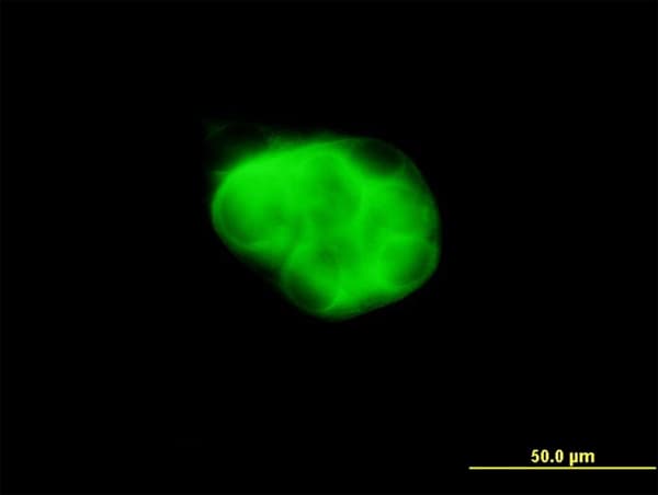 Monoclonal Mouse anti-Human DCAKD Antibody (clone 3E4, IF, WB)