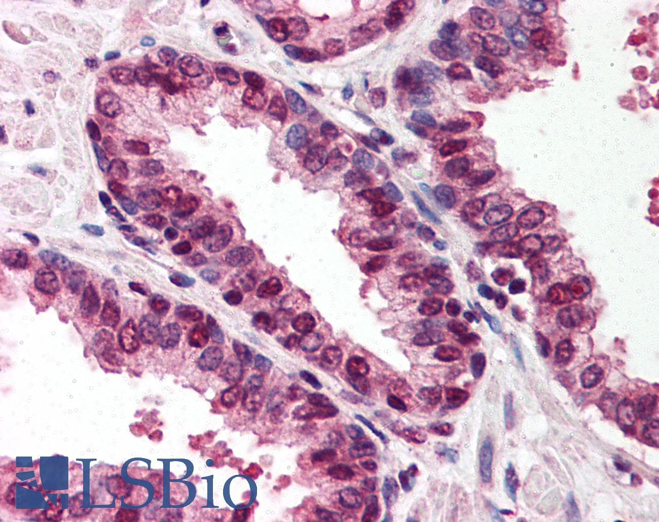 IHC-plus™ MTA2 Antibody