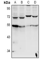 CYP-M / CYP20A1 Antibody