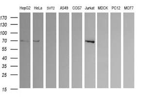 Monoclonal Mouse anti-Human CD105 Antibody (clone OTI9E5, IF, WB)