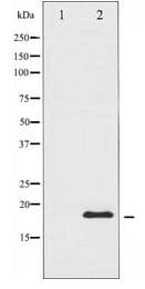 STMN1 / Stathmin / LAG Antibody