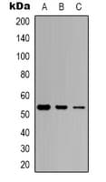Polyclonal Rabbit anti-Human TP53 / p53 Antibody (N-Terminus, WB)