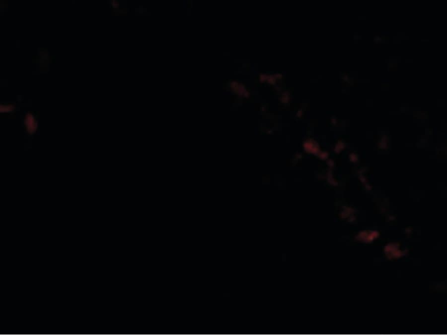 GOPC / PIST Antibody