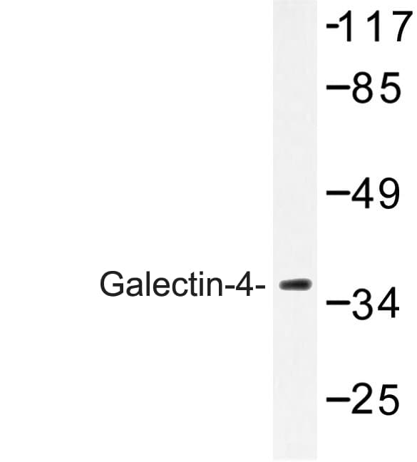 GAL4 / Galectin 4 Antibody (Lys83)
