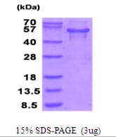 Human MTHFSD Protein (Recombinant His)