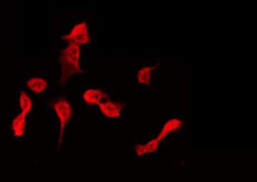 Polyclonal Rabbit anti-Human APOBEC3D Antibody (IHC, IF, WB)