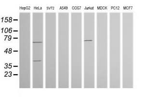 TRMT2A Antibody (clone OTI2C6)