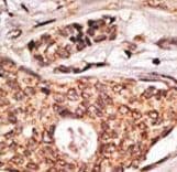 ICOS / CD278 Antibody (aa156-185)