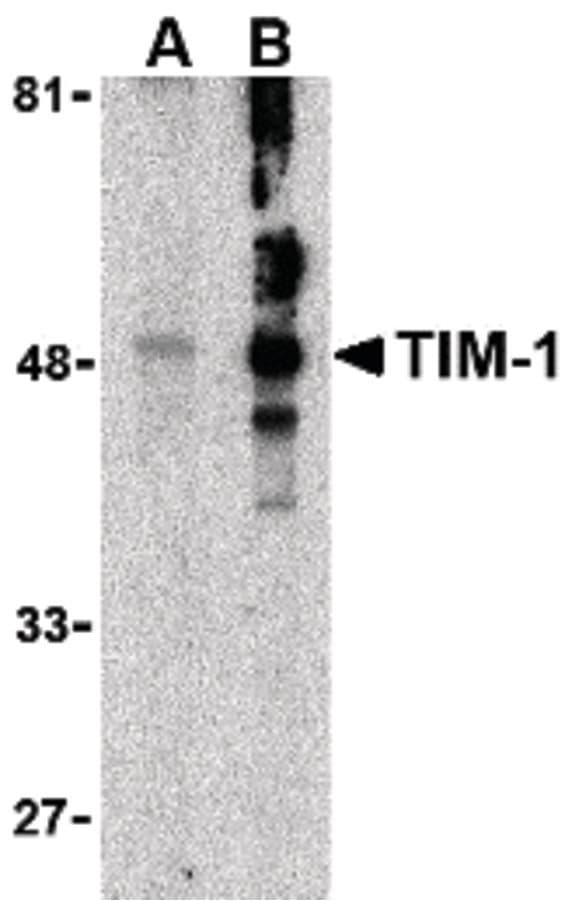 PathPlus™ HAVCR1 / KIM-1 Antibody