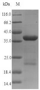 Human Dystonin / BPAG1 Protein (Recombinant 6His-SUMO, N-terminus)
