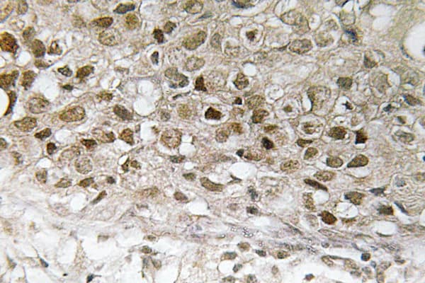 MAP2K1 / MKK1 / MEK1 Antibody (phospho-Thr292)