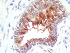 BIRC3 / cIAP2 Antibody (Internal)