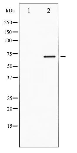 Polyclonal Rabbit anti-Human FOXO1 / FKHR Antibody (phospho-Ser319, IHC, WB)