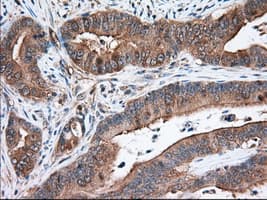 ERIC-1 / TACC3 Antibody (clone OTI7B11)