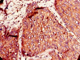SLC12A7 / KCC4 Antibody