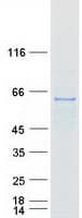 Human RNMT / HCM Protein (Recombinant Myc-DDK (Flag))