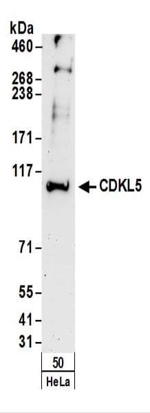 STK9 / CDKL5 Antibody (aa350-400)