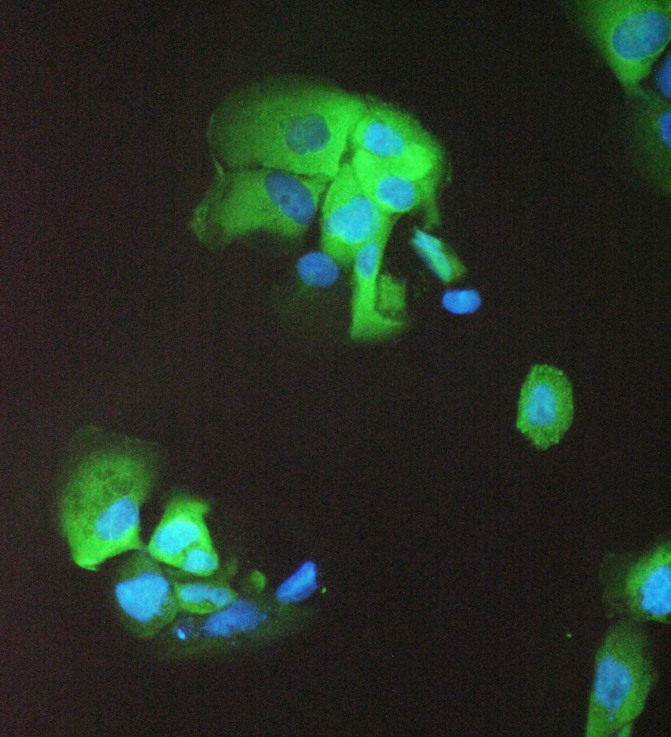 Polyclonal Rabbit anti-Human SFN / Stratifin / 14-3-3 Sigma Antibody (WB)