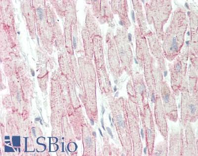 IHC-plus™ Polyclonal Rabbit anti-Human BVES Antibody (aa241-360, IHC, WB)