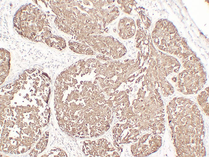PathPlus™ EMA / MUC1 Antibody (clone ABT-EMA)