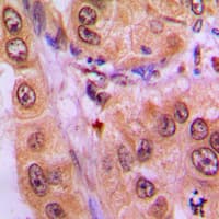 Polyclonal Rabbit anti-Human STAT3 Antibody (phospho-Tyr705, IHC, WB)