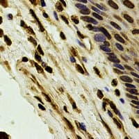 QIP1 / KPNA4 Antibody