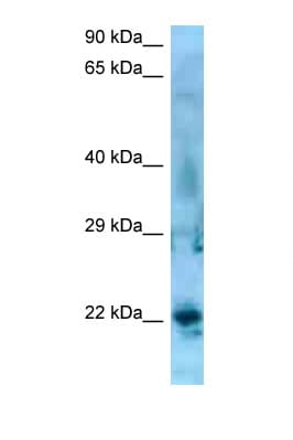 SSX5 Antibody (aa119-168)