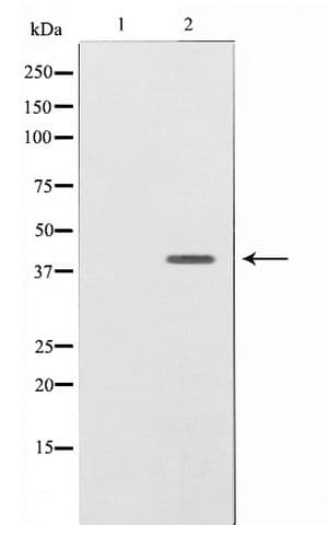 NRG1 / Heregulin / Neuregulin Antibody