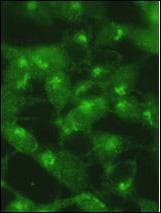 Polyclonal Rabbit anti-Human MAP1LC3A / LC3A Antibody (aa89-120, IHC, IF, WB)