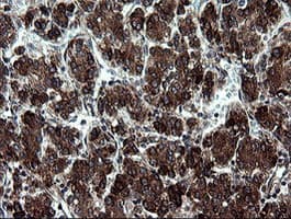 ARMC1 Antibody (clone OTI1D10)
