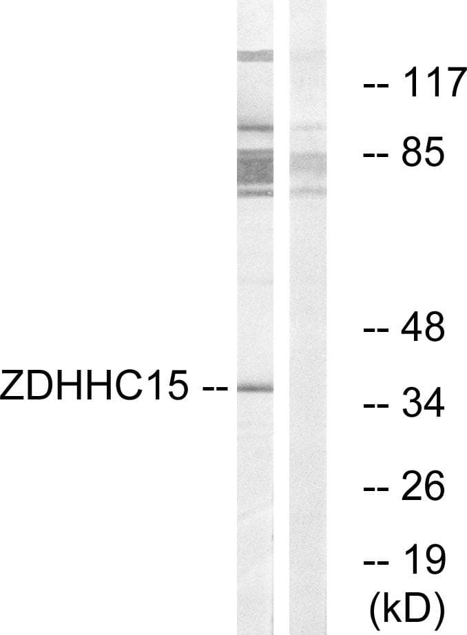 Polyclonal Rabbit anti-Human ZDHHC15 Antibody (WB)