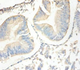 SLPI / Antileukoproteinase Antibody