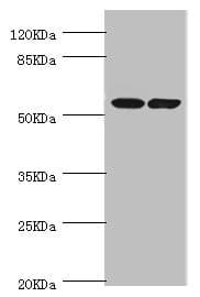 DPYS / Dihydropyrimidinase Antibody