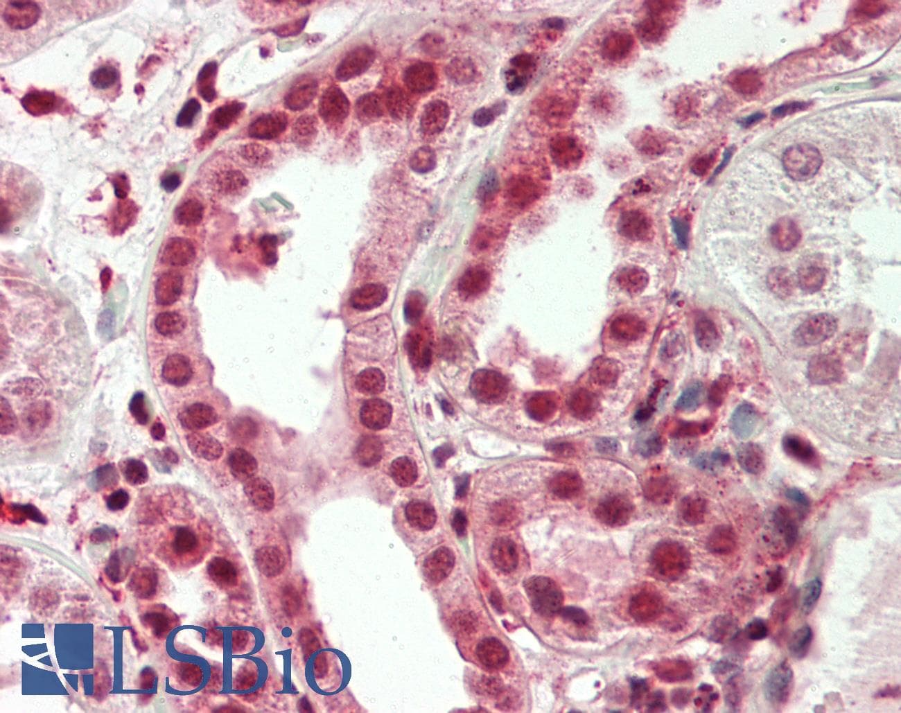 IHC-plus™ STAG1 / SA1 Antibody (aa1125-1175)