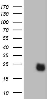 TTF / RHOH Antibody (aa97-190, clone OTI8C7)
