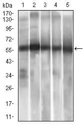 ALDH2 Antibody (aa317-517, clone 4G6A3)