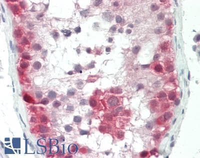 IHC-plus™ Polyclonal Rabbit anti-Human Cullin 4A / CUL4A Antibody (IHC, IF, WB)