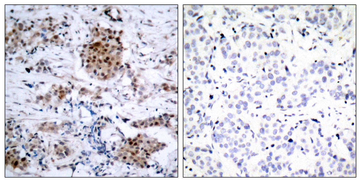 ER Alpha / Estrogen Receptor Antibody (phospho-Ser167)