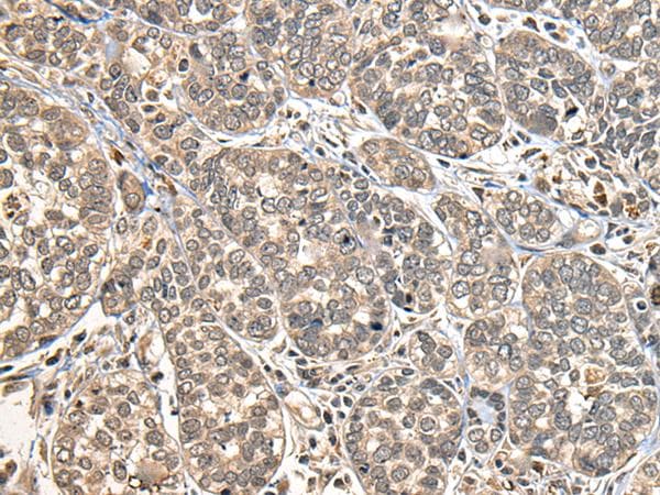 DGK-IOTA / DGKI Antibody