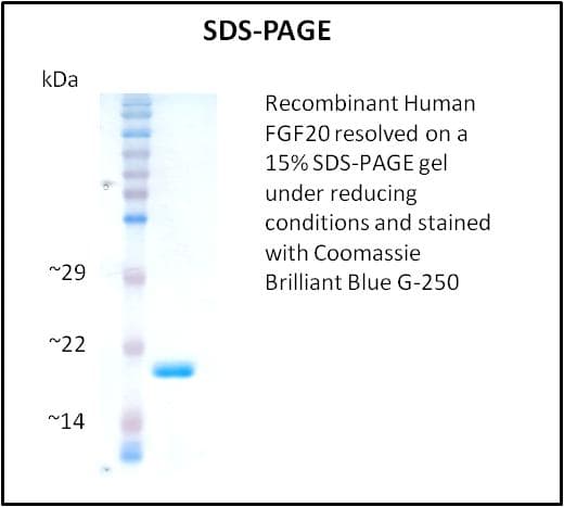 Human FGF20 Protein (Recombinant)