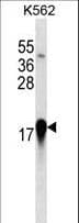 EIF4EBP1 / 4EBP1 Antibody