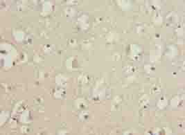 Polyclonal Rabbit anti-Human MAB21L1 Antibody (IHC, WB)